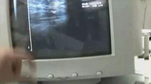27544